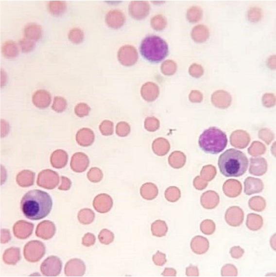 Representative cytological image of a bone marrow smear stained with the May–Grünwald–Giemsa method showing basophilic erythroblasts in the HD group on day 28; 1,000×