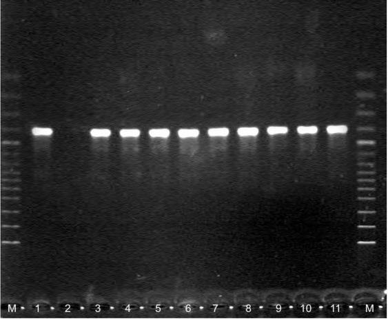 PCR amplification of a partial sequence of B. canis 18S RNA gene (product size 559 bp)M – 100bp molecular weight marker; 1 – positive control; 2 – negative control; 3–11 – studied samples from dogs with babesiosis