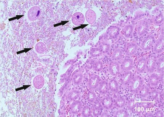 Balantidium coli (arrows) in the intestinal lumen (haematoxylin and eosin, × 100)