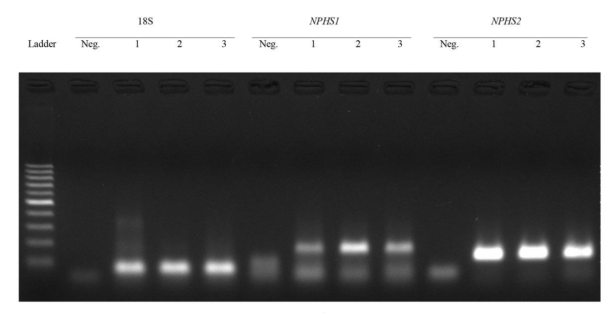 cDNA product electrophoresis in 1.5% agarose gel. Neg. – negative control; Column 1 – sample from a dog with stage 3 chronic kidney disease; Column 2 – sample from a dog of the control group; Column 3 – sample from a dog with stage 1 chronic kidney disease. The length of 18S was 80 bp, that of NPHS1 was 156 bp, that of NPHS2 was 140 bp, and the DNA ladder was 100 bp long