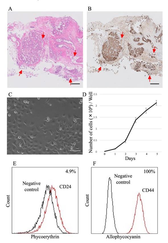 Histopathological examination and data analysis. A – infiltration of cancer cells into the lymphatic vessels (arrows); scale bar: 200 μm. B – immunostaining with cytokeratin 1/3 antibody showing cancer cells with infiltration into the lymphatic vessels to be of epithelial origin (arrows); scale bar: 200 μm. C – IMC-1 cells with epithelial characteristics as polygonal or circular shapes and arranged in a paving stone pattern without contact inhibition; scale bar: 100 μm. D – cell proliferation rate indicating 31 h doubling time. E and F – flow cytometric investigation of expression of CD24 and CD44 in IMC-1. Values represent the mean ± standard error (n = 6)