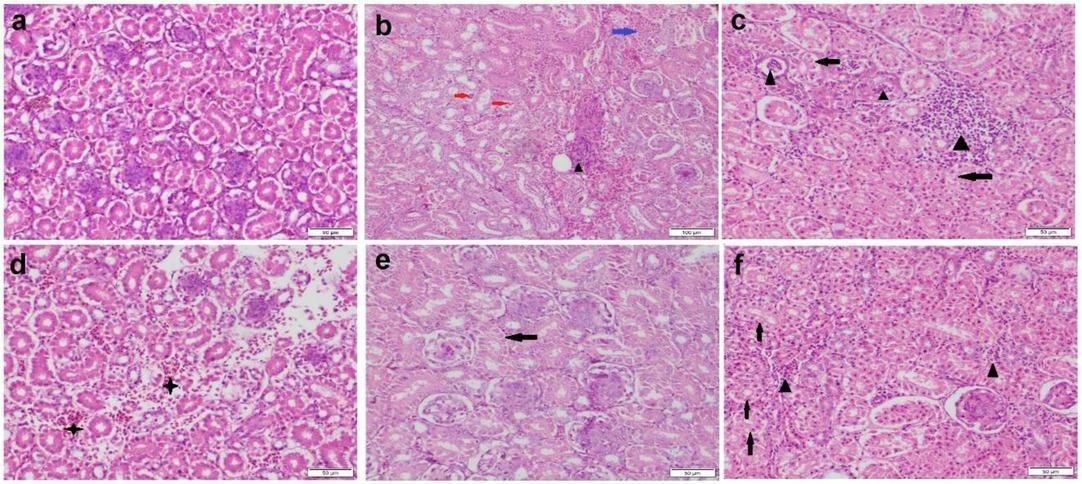 Photomicrograph of kidney tissue sections stained by haematoxylin and eosin. a – control group with normal histological structure; b–d – ochratoxin A (OTA) group showing vacuolar degeneration (black arrows), necrosis (blue arrow) and desquamation (red arrows) of tubular epithelium, tubular and interstitial inflammatory cell infiltration (black triangles) and interstitial haemorrhage (black stars); e–f – Bacillus subtilis fermentation extract + OTA group showing moderate vacuolar degeneration (black arrows) in some tubular epithelial cells and mild interstitial inflammatory cell infiltration (black triangles)