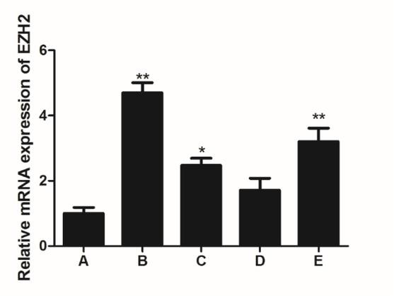 Transcription level of the EZH2 gene in canine normal mammary gland and CMC tissuesA – normal canine mammary tissues; B – infiltrating ductal carcinoma; C – intraductal papillary carcinomas; D – infiltrating micropapillary carcinoma; E – ductal carcinoma in situ Results are presented as mean ± SD of tissues in the group. * P < 0.05 and ** P < 0.01 show significantly different by one ANOVA test