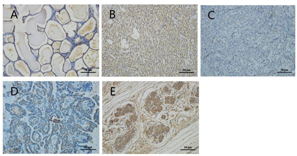 Expression of the EZH2 protein in normal canine mammary gland and CMC tissue as revealed by immunohistochemical staining (200 ×)A – normal canine mammary tissues; B – infiltrating ductal carcinoma; C – intraductal papillary carcinomas;
D – infiltrating micropapillary carcinoma; E – ductal carcinoma in situ. Scale bars: 50 μm