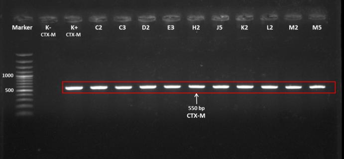 Gel picture showing the presence of the blaCTX-M gene in extended-spectrum beta lactamase–producing E. coli bp – base pairs