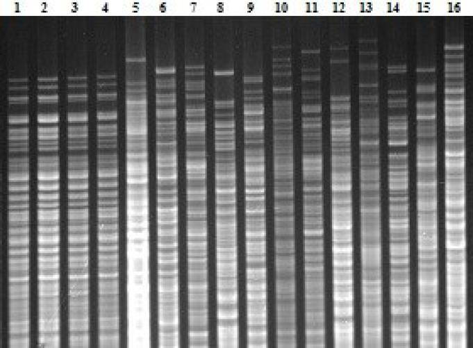 Restriction endonuclease analysis patterns of chromosomal DNA from Leptospira strains digested with EcoRI. Lanes: 1 – Icterohaemorrhagiae (RGA strain); 2 – Copenhageni (M20 strain); 3 – Monymusk (LT 75-68 strain); 4 – Budapest (PV-1 strain); 5 – Mankarso (Mankarso strain); 6 – Naam (Naam strain); 7 – Birkini (Birkin strain); 8 – Bogvere (LT 60-69 strain); 9 – Dakota (Grand River strain); 10 – Gem (Simon strain); 11 – Lai (Lai strain); 12 – Mwogolo (Mwogolo strain); 13 – Ndambari (Ndambari strain); 14 – Ndahambukuje (Ndahambukuje strain); 15 – Smithi (Smith strain); 16 – Tonkini (LT 96-68 strain)