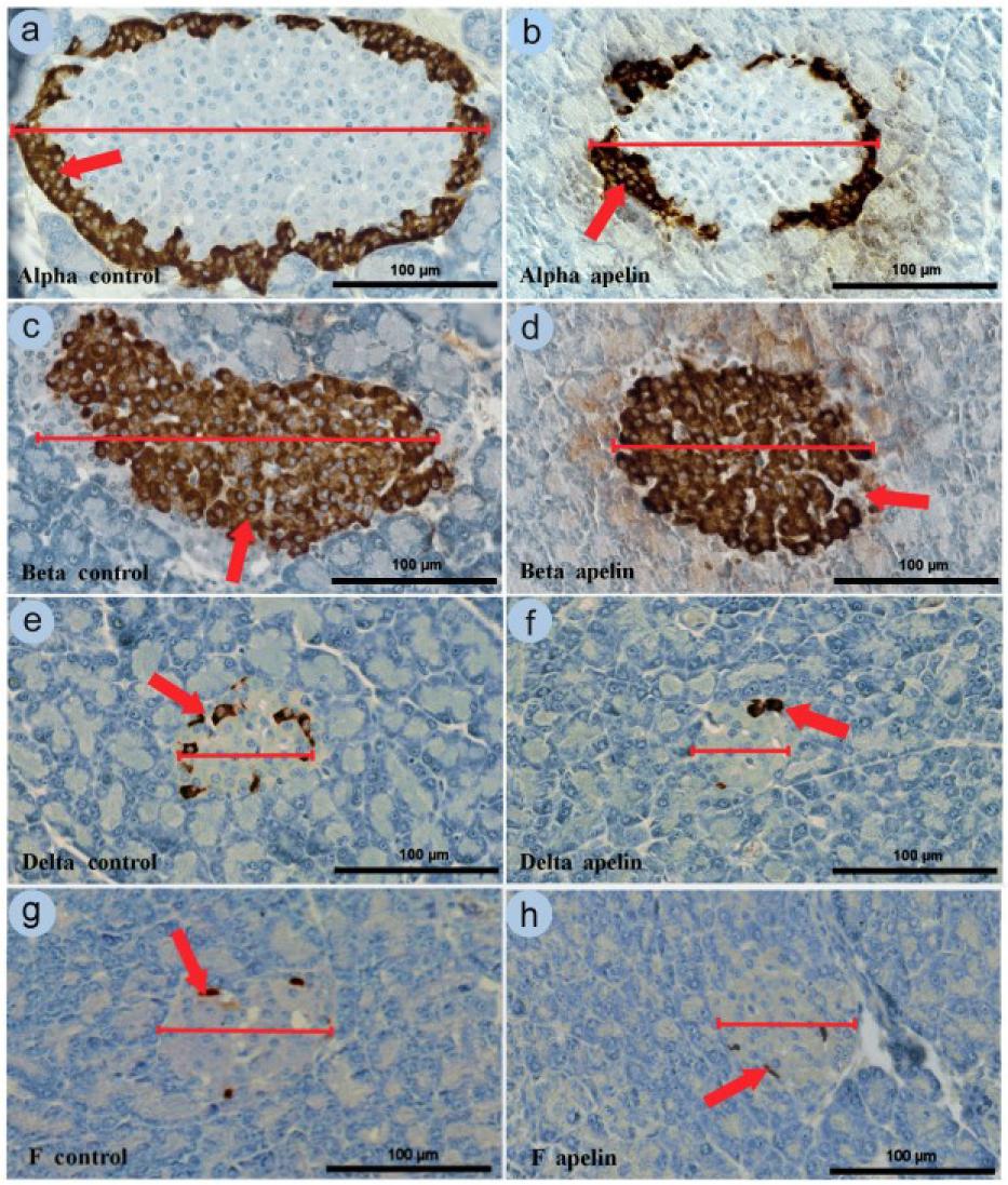 (a and b) Immunoreactivity of glucagon, (c and d) insulin, (e and f) somatostatin and (g and h) pancreatic polypeptide in (a–d) large and (e–h) small pancreatic islets: a, c, e and g – control group; b, d, f and h – apelin group. Red lines indicate the diameter of the islet and red arrows indicate changes in immunoreactive cell density (cells/1,000 µm2). Scale bar: 100 µm