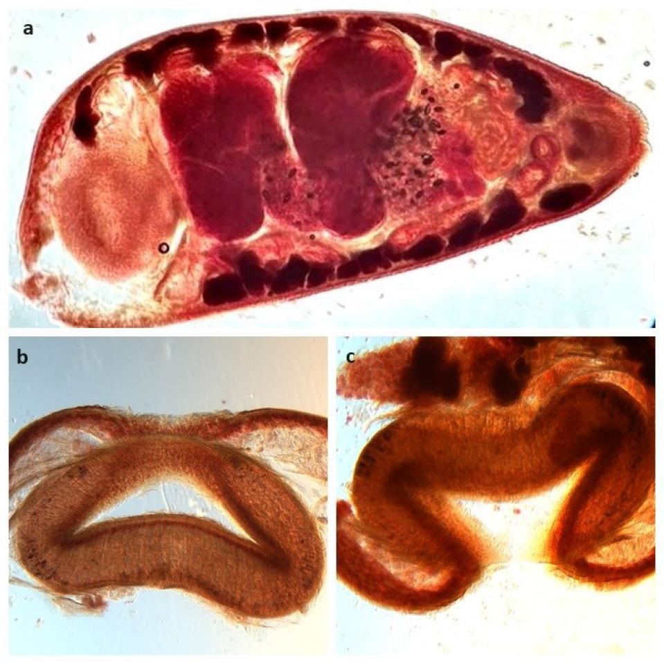 Morphology (sagittal section) of Calicophoron daubneyi: a) whole worm; b and c) acetabulum
