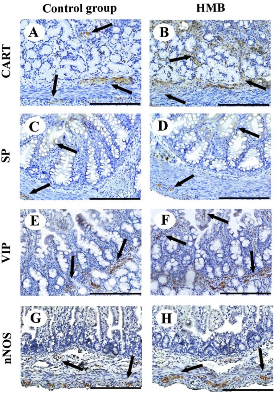 Representative photomicrographs of the immunohistochemical reactions for cocaine-and-amphetamine-regulated transcript (CART) (A and B), substance P (SP) (C and D), vasoactive intestinal peptide (VIP) (E and F) and neuronal nitric oxide synthase (nNOS) (G and H) in the duodenum (A, B, E and F) and jejunum (C, D, G and H) of control (A, C, E and G) and prenatally HMB-exposed (B, D, F and H) piglets. Arrow – positive reaction. Scale bar = 200 μm