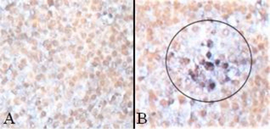 Detection of an AciHV-like virus in spleen tissue. A – irregular KHV probe; B – AciHV-HV probe