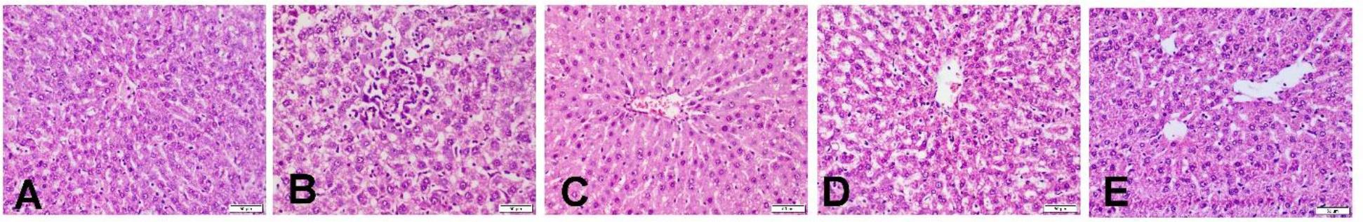 Photomicrographs of haematoxylin and eosin–stained sections of the liver in different experimental groups of Wistar rats subjected to hepatorenal toxic insult by diclofenac sodium (DIC) after being administered or denied protective compounds. A – the liver of a negative control group rat showing normal histological architecture of liver tissue. B – the liver of a DIC-treated and hepatorenally unprotected group rat showing diffused hydropic degeneration of hepatocytes, apoptosis, hepatocellular necrosis and mononuclear infiltration. C – the liver of a silymarin-treated group rat dosed at 100 mg/kg body weight (b.w.) showing hepatocellular regeneration and mild vacuolar degeneration. D – the liver of an α-lipoic acid (ALA)-treated group rat dosed at 50 mg/kg b.w. showing moderate vacuolar degeneration. E – the liver of an ALA-treated group rat dosed at 100 mg/kg b.w. showing marked hepatocellular regeneration, mild cellular necrosis and fatty changes