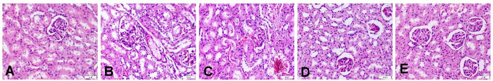 Photomicrographs of haematoxylin and eosin–stained sections of the kidney in different experimental groups of Wistar rats subjected to hepatorenal toxic insult by diclofenac sodium (DIC) after being administered or denied protective compounds. A – the kidney of a negative control group rat showing normal renal architecture with a normal glomerulus and renal tubule arrangement. B – the kidney of a DIC-treated and hepatorenally unprotected group rat showing vacuolisation in the endothelial lining of the glomerular tuft, congestion of renal vessels, desquamation of tubular cells with intraluminal eosinophilic cast formation, severe fatty change in the epithelial lining of renal tubules and necrosis of renal tubules. C – the kidney of a silymarin-treated group rat dosed at 100 mg/kg body weight (b.w.) showing dilation and congestion of renal vessels, tubular cell desquamation and intraluminal cast formation. D and E – the kidneys of α-lipoic acid–treated group rats dosed at 50 mg/kg b.w. or 100 mg/kg b.w. showing marked improvement in renal alterations, restored normal histological structure of the endothelial cell lining of the glomerular tuft and reduced renal necrosis