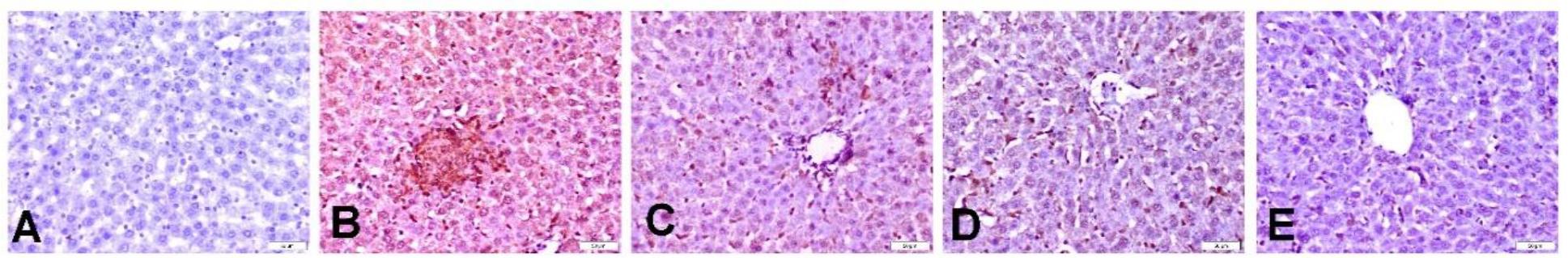 Photomicrographs of caspase-3 activity in livers in different experimental groups of Wistar rats subjected to hepatorenal toxic insult by diclofenac sodium (DIC) after being administered or denied protective compounds. A – the liver of a normal control group rat showing no detectable caspase-3 immunostaining. B – the liver of a DIC-treated and hepatorenally unprotected group rat showing strong caspase-3 immunostaining of hepatocytes undergoing apoptosis. C – the liver of a silymarin-treated group rat dosed at 100 mg/kg body weight (b.w.) showing moderately stained hepatocytes. D – the liver of an α-lipoic acid–treated group rat dosed at 50 mg/kg b.w. showing moderate caspase-3 immunostaining of hepatocytes. E – the liver of an α-lipoic acid–treated group rat dosed at 100 mg/kg b.w. showing a reduction of the immunopositive cells
