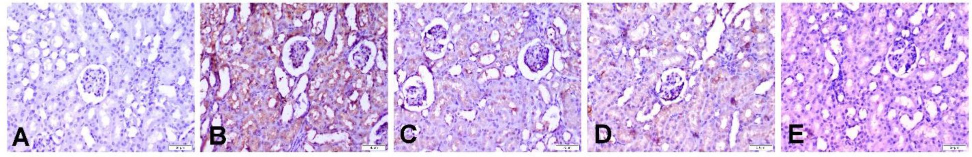 Photomicrographs of caspase-3 activity in kidney in the different experimental groups of Wistar rats subjected to hepatorenal toxic insult by diclofenac sodium (DIC) after being administered or denied protective compounds. A – the kidney of a normal control group rat showing no expression of caspase-3 in the renal corpuscles and tubules. B – the kidney of a DIC-treated and hepatorenally unprotected group rat showing strong positive caspase-3 expression in the glomeruli and tubules. C – the kidney of a silymarin-treated group rat dosed at 100 mg/kg body weight (b.w.) showing moderately stained glomeruli and tubules. D and E – the kidneys of α-lipoic acid–treated group rats dosed at 50 mg/kg b.w. or 100 mg/kg b.w. showing a reduction of the immunopositive cells