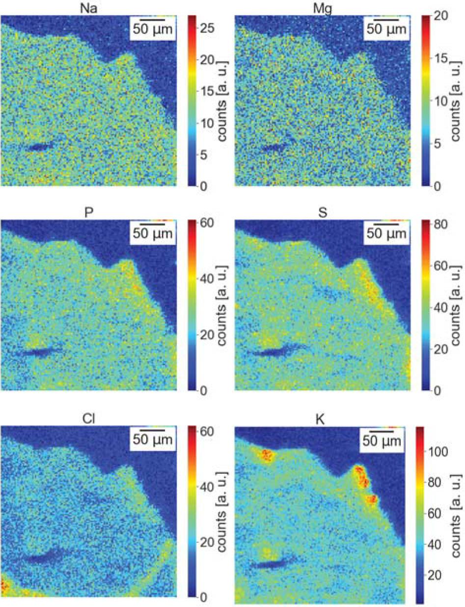 Element distribution maps of dystrophy sample made with the PIXE method.