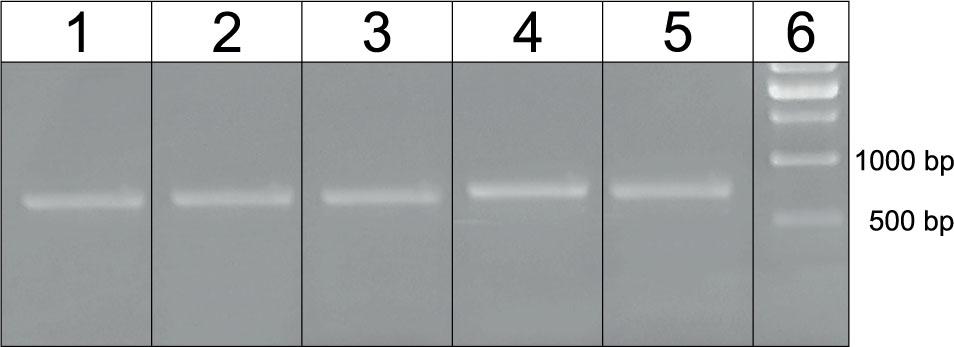 Detection of Enterobacteriaceae vanA gene coding for vancomycin resistance. Lane 1: E. coli, 2: E. coli, 3: S. liquefaciens, 4: C. braakii, 5: E. cloacae, 6: DNA size marker