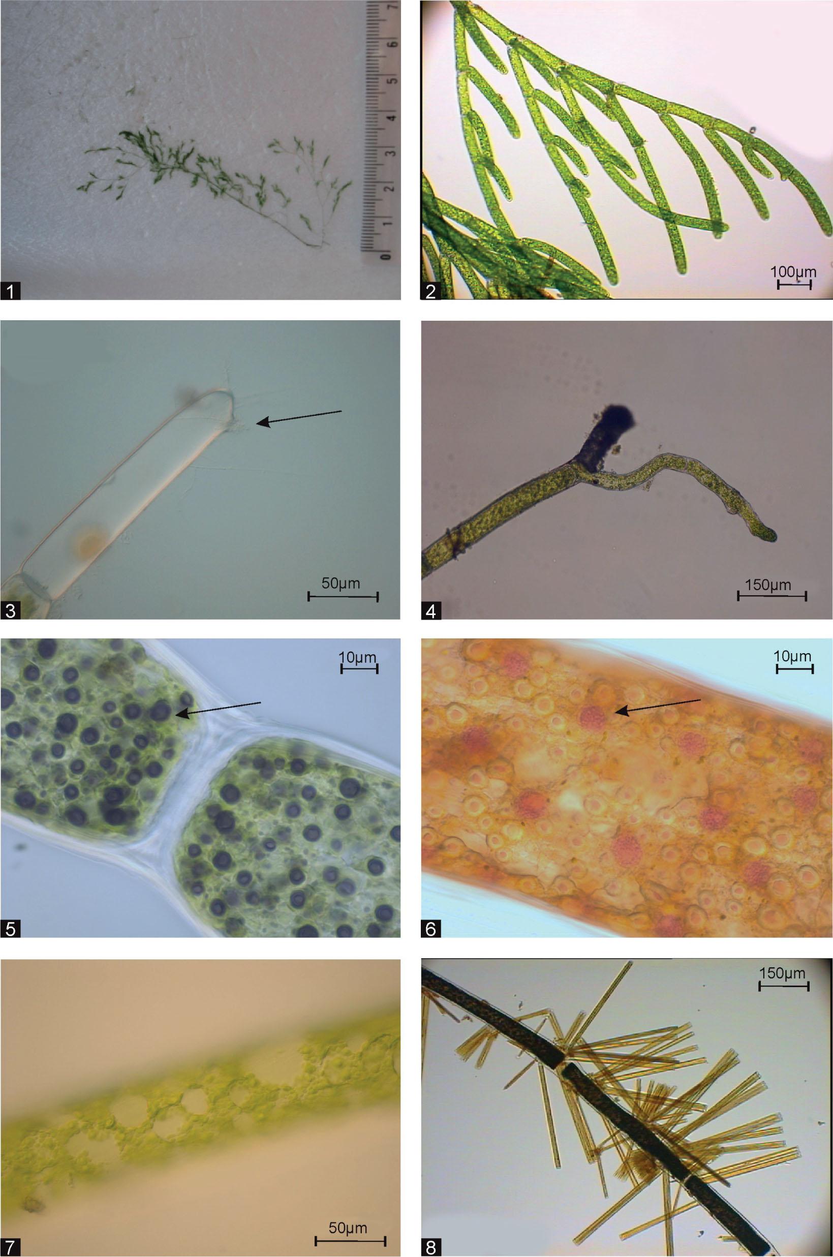 Photos of Cladophora glomerata: 1 – the overall view of young thalli; 2 – the number of thalli branched in the apical part; 3 – apical cell with a hole; 4 – basal cell; 5 – stained pyrenoids; 6 – stained nuclei; 7 – reticulate chloroplast; 8 – diatoms on the surface of cell wall