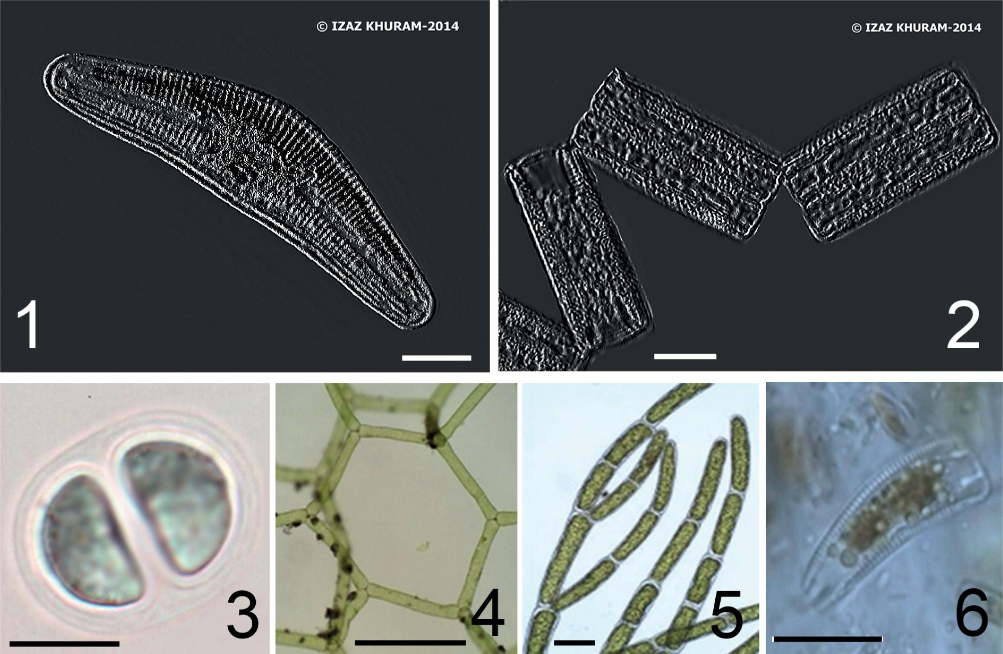 The most distributed algal species-indicators in the Kabul River communities with their ecological preferences: Cymbella affinis Kützing (benthic, temperature-temperate, low-streaming waters, pH-indifferent, saproxene, oligosaprobe, oligotraphentic, autotrophic) (1); Diatoma vulgaris Bory (planktonic-benthic, low-streaming waters, chloride-indifferent, saproxene, beta-mesosaprobic, meso-eutraphentic, autotrophic) (2); Chroococcus turgidus (Kützing) Nägeli (planktonic-benthic, aerophile, halophile, xeno-beta-mesosaprobic) (3); Hydrodictyon reticulatum (Linnaeus) Bory (planktonic-benthic, standing water, oligo-alpha-mesosaprobic) (4); Cladophora glomerata (Linnaeus) Kützing (planktonic-benthic, low-streaming waters, chloride-indifferent, oligo-alpha-mesosaprobic) (5); Rhoicosphenia abbreviata (C.Agardh) Lange-Bertalot (benthic, low-streaming waters, chloride-indifferent, eurysaprobe, oligo-alpha-mesosaprobic, meso-eutraphentic, autotroph) (6). Scale bar: fig. 2(1-4): 6-10 μm; fig. 2(5): 50 μm