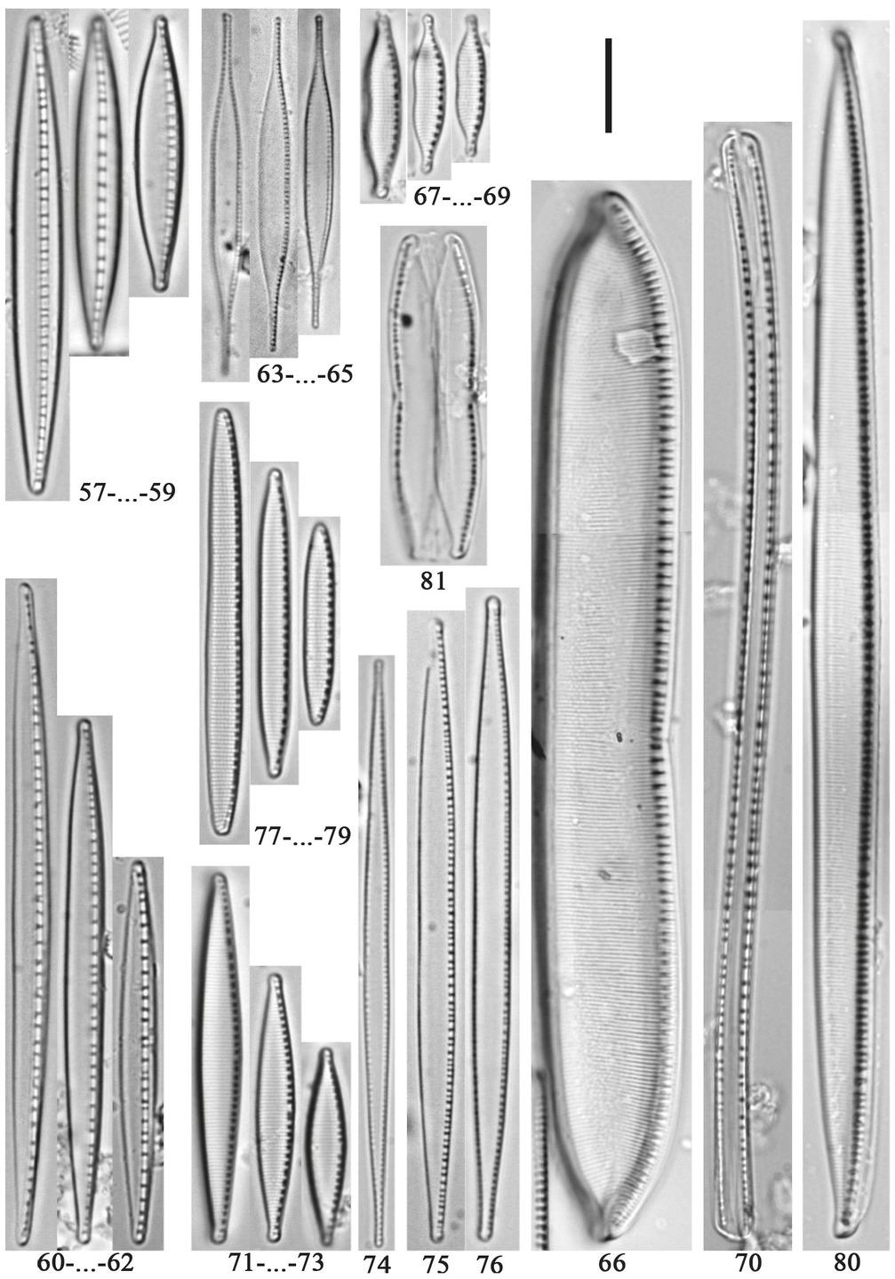 57–59 – Nitzschia dissipata (Kützing) Rabenhorst; 60–62 – N. dissipata var. media (Hantzsch) Grunow; 63–65 – N. draveillensis Coste & Ricard; 66 – N. dubia W.Smith; 67–69 – N. elegantula Grunow; 70 – N. flexa Schumann; 71–73 – N. fonticola (Grunow) Grunow; 74 – N. graciliformis Lange-Bertalot & Simonsen; 75, 76 – N. gracilis Hantzsch; 77–79 – N. hantzschiana Rabenhorst; 80 – N. heufleriana Grunow; 81 – N. homburgiensis Lange-Bertalot. Scale bar: 10 μm