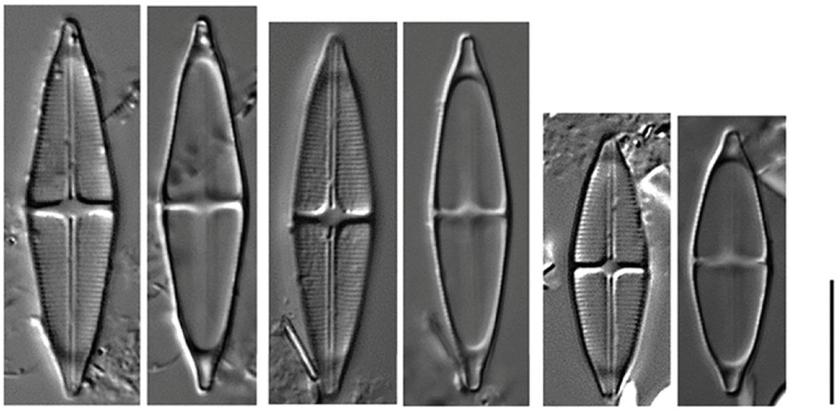 Diminution series of the Stauroneis balatonis population from Lake Savsko. Scale: 10 μm