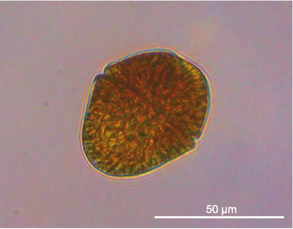 LM of Akashiwo sanguinea
