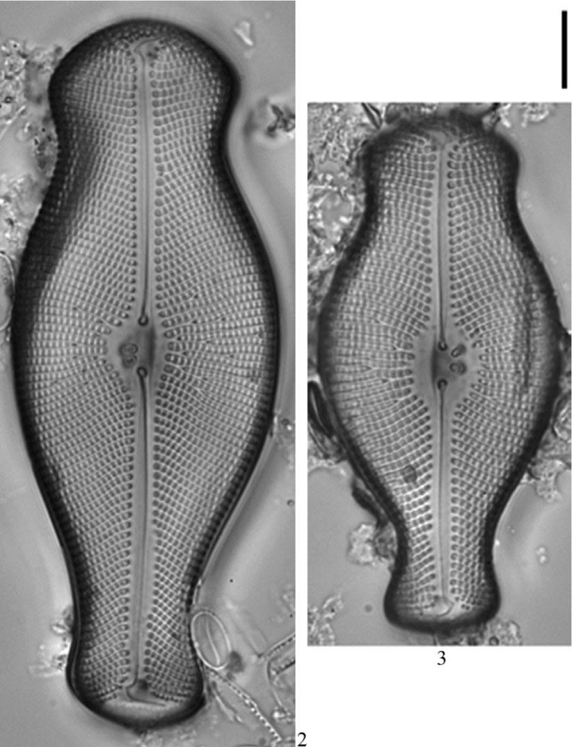 2, 3 – Didymosphenia geminata (Lyngbye) M.Schmidt. Scale bar: 10 µm