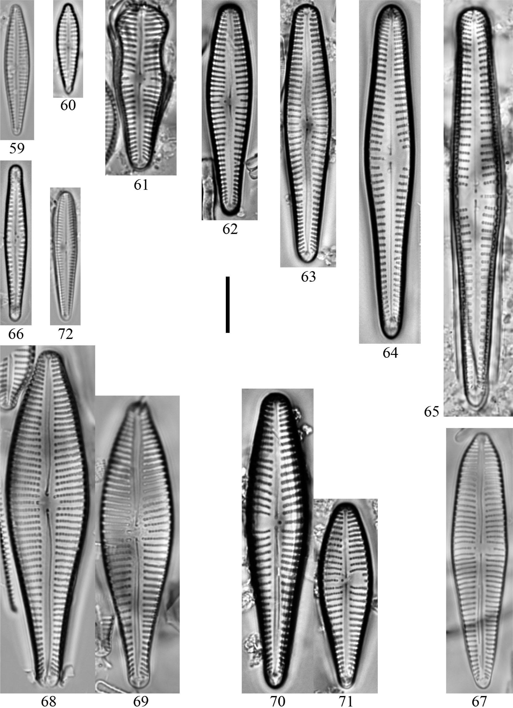 59, 60 – G. cf subangustatum Lange-Bertalot, Cavacini, Tagliaventi & Alfinito; 61 – G. subcapitatum (Grunow) E. Reichardt & Levkov; 62, 63 – G. subclavatum (Grunow) Grunow; 64, 65 – G. vibrio Ehrenberg; 66 – Gomphonema sp. 1; 67 – Gomphonema sp. 2; 68, 69 – Gomphonema sp. 3; 70, 71 – Gomphonema sp. 4; 72 – Gomphosphenia holmquistii (Foged) Lange-Bertalot. Scale bar: 10 µm