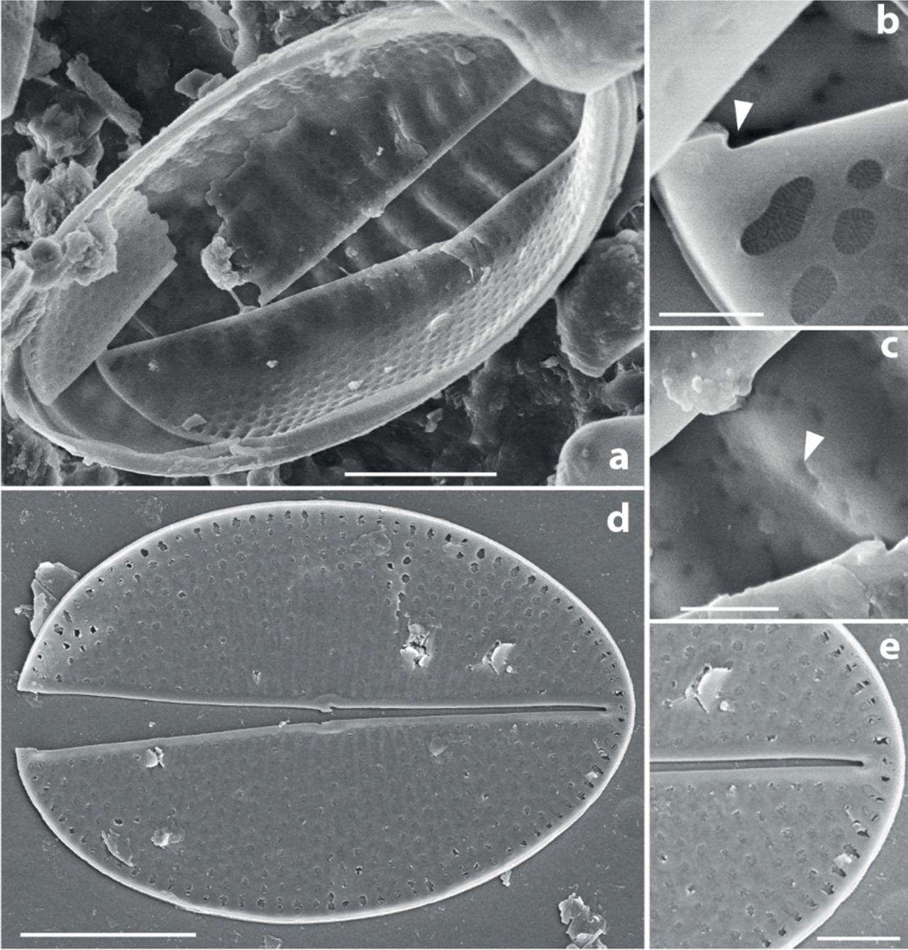 Upsilococconeis dapalistriata. SEM. RV. (Fig. 6a–c, specimen from New Caledonia; Figs 6d–e, specimen from Komodo). Fig. 6a, RV in external view. Fig. 6b, simple terminal raphe ending (arrowhead) and RV areola occlusion with radiate slits. Fig. 6c, leopard-like dots indicating the SVVC (arrowhead). Fig. 6d, RV in internal view, with low helictoglossae and small central area. Fig. 6e, helictoglossa. Scale bars: 3 μm (Figs 6a,d), 1 μm (Fig. 6e), 500 nm (Fig. 6c), 400 nm (Fig. 6b).