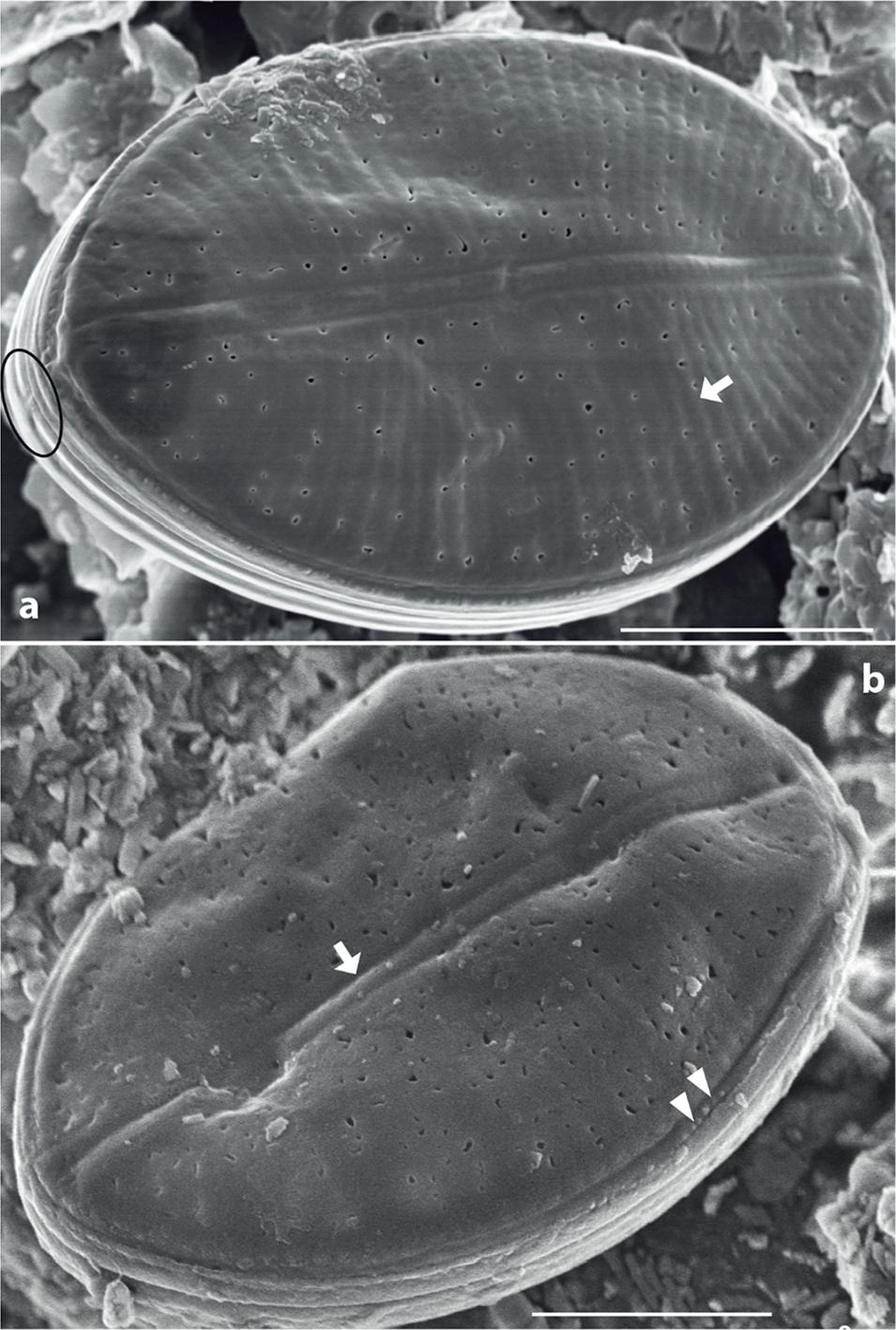 Upsilococconeis dapalistriata. SEM. Extended RVVC in advalvar view. (Fig. 19, specimen from Komodo; Fig. 20, specimen from New Caledonia). Fig. 19, Note the radiate furrows corresponding to the underlying RV striae (arrow). Note the open additional cingular band (black ellipse). Fig. 20, Note the axial furrows indicating the underlying RV raphe (arrow). Note the marginal furrow with small structures (twin arrowheads). Scale bars: 3 μm (Figs 19–20).