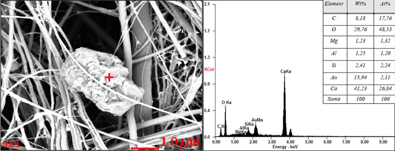 Microphotograph of a particle on the surface of a glass filter and its chemical composition