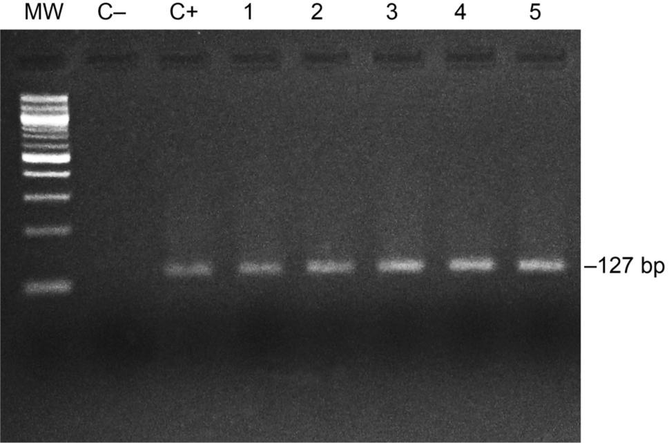 2.5% agarose gel electrophoresis stained with ethidium bromide, showing the amplification of five fecal samples positives for H. pylori.C–: Negative control; C+: Positive control (H. pylori strain 26695); MW: Molecular weight 100 bp.