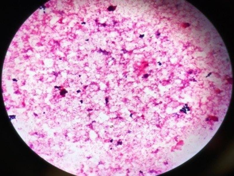 Microscopic appearance of Gram-positive bacteria after Gram staining with the routine method at a magnification of 1000×.