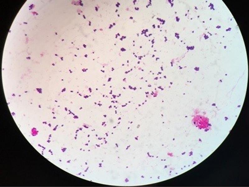 Microscopic appearance of Gram-positive bacteria after Gram staining with the rapid method at a magnification of 1000×.