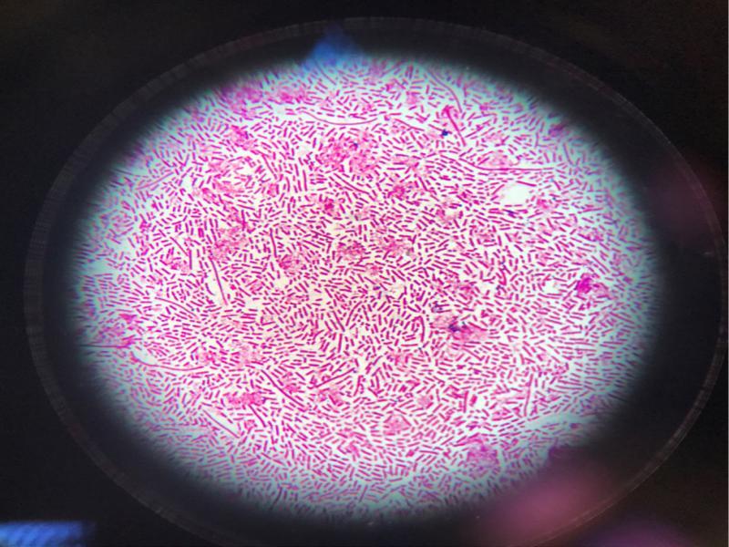 Microscopic appearance of Gram-negative bacteria after Gram staining with the rapid method at a magnification of 1000×.