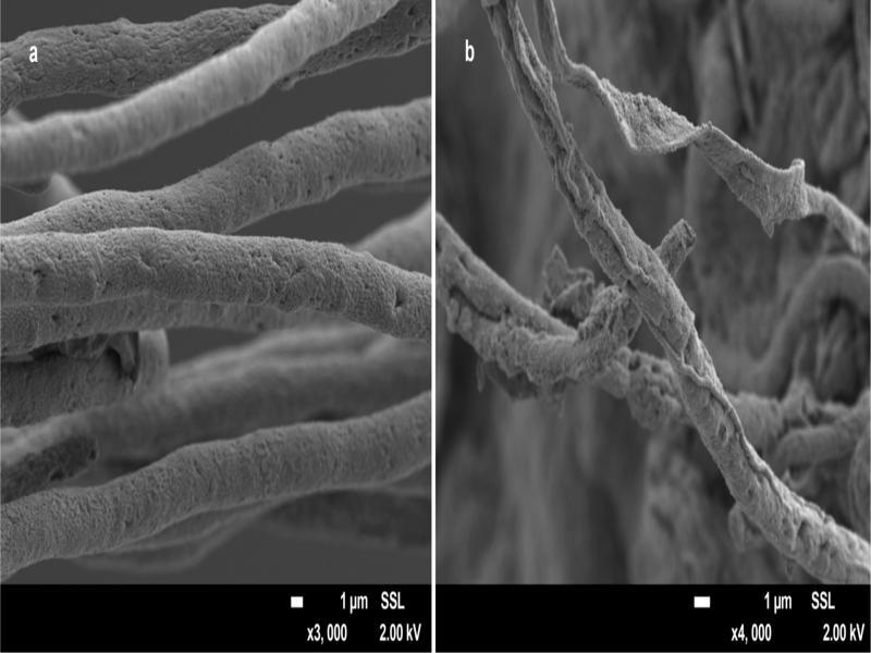Scanning electron micrograph showing morphological changes in the hyphae of Monosporascus cannonballus at the edge of the inhibition zone after co-cultivation with Nigrospora sphaerica E1 in PDA platesa) Hyphae of M. cannonballus in the control; b) Hyphae of M. cannonballus after co-cultivation with N. sphaerica E1.