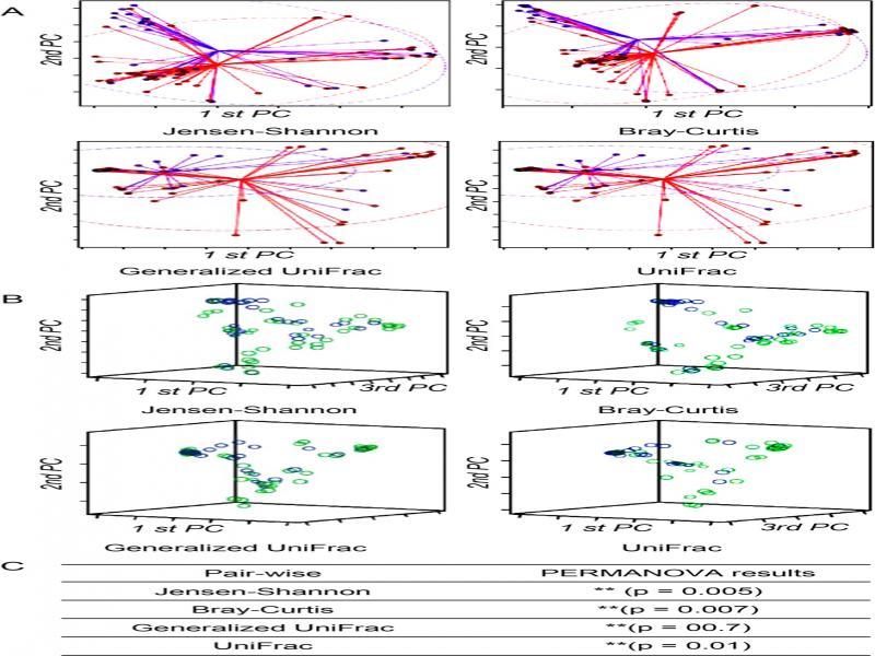 Beta diversity of microbial communities based on Jensen-Shannon divergence, Bray-Curtis, Generalized UniFrac, and UniFrac.A) PCoA plots were produced as an ellipse in two dimensions based on a 95% confidence interval. B) PCoA plots were also presented in 3D. The blue/purple color indicates normal control women, and the light green/red color indicates PID patients, respectively. C) Permutational multivariate analysis of variance (PERMANOVA) results demonstrated the beta set-significance between the PID patient and normal control women groups. **p < 0.01.