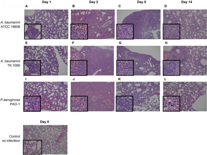 Histopathological analysis of the lung tissues from Acinetobacter baumannii- and Pseudomonas aeruginosa-infected mice. The lung tissues from C3H/HeN mice infected with ATCC 19606 (A, B, C, and D), TK1090 (E, F, G, and H), and PAO-1 (I, J, K, and L) strains and uninfected mouse (M) are shown. The lung tissues from the mice infected with ATCC 19606 at 1 day (A), 2 days (B), 5 days (C), and 14 days (D) post-infection. The lung tissues from the mice infected with TK1090 at 1 day (E), 2 days (F), 5 days (G), and 14 days (H) post-infection. The lung tissues from the mice infected with PAO-1 at 1 day (I), 2 days (J), 5 days (K), and 14 days (L) post-infection. Photomicrograph images (magnification, 100×; hematoxylin and eosin staining). Squares represent high magnification (400×).
