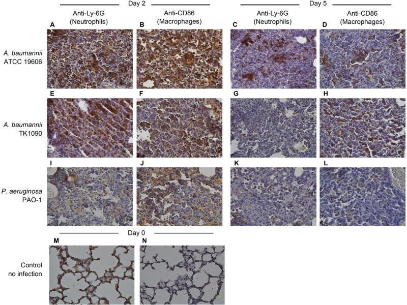 Infiltration of neutrophils and macrophages in the lung tissues of Acinetobacter baumannii- and Pseudomonas aeruginosa-infected mice. The lung tissues from C3H/HeN mice infected with ATCC19606 (A, B, C, and D), TK1090 (E, F, G, and H), and PAO-1 (I, J, K, and L) strains and uninfected mice (M and N) are shown. The lung tissues from the mice infected with ATCC 19606 at 1 day (A and B) and 5 days (C and D) post-infection. The lung tissues from the mice infected with TK1090 at 1 day (E and F) and 5 days (G and H) post-infection. The lung tissues from the mice infected with PAO-1 at 1 day (I and J) and 5 days (K and L) post-infection. Neutrophils and macrophages were detected by immunostaining with anti-Ly-6G antibody (A, C, E, G, I, and K) and anti-CD68 antibody (B, D, F, H, J, and L) using diaminobenzidine (DAB) method and restained with hematoxylin, respectively. Photomicrograph images (magnification, 100×).