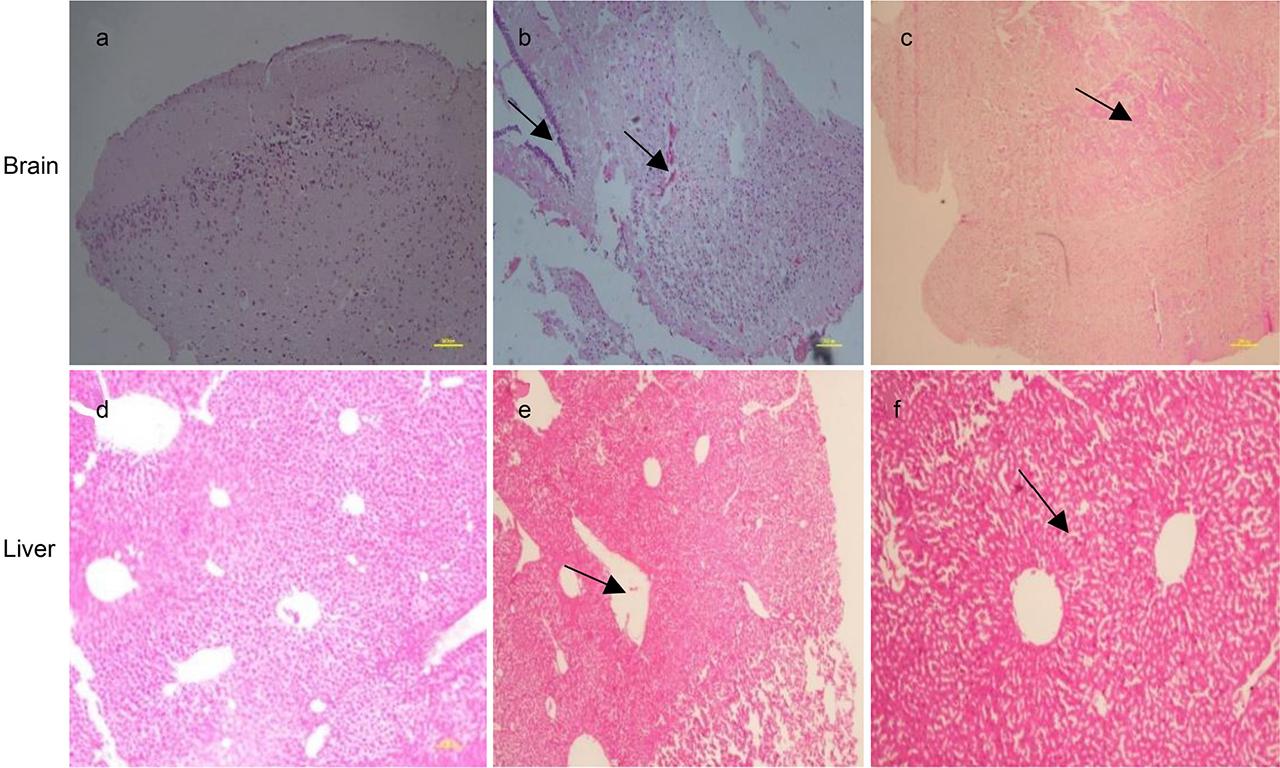 Pathological changes in the tissue of infected mice stained with hematoxillin-eosin. a/d – Normal mouse, b/e – the mice immunized with normal saline, c/f – the mice immunized with protein and challenged with bacteria.