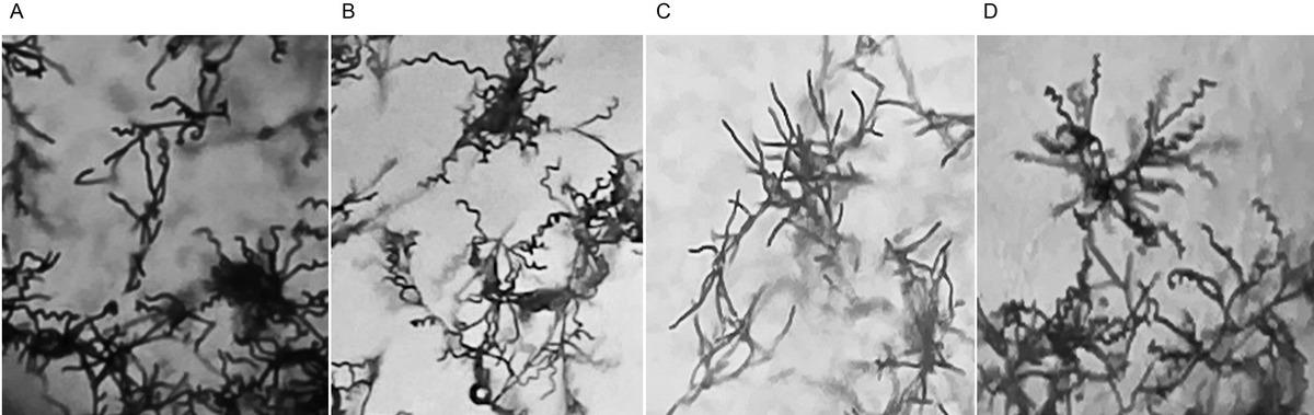 Spore chain morphologies of actinomycete isolates. Spore chain morphologies of actinomycetes Ac-1 (A), Ac-2 (B), Ac-6 (C), and Ac-9 (D) as observed under a light microscope (magnification 100×).