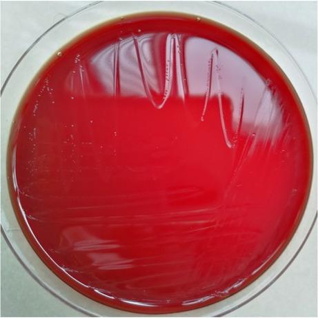 Culture of the pure E. lenta isolate after 72 h.