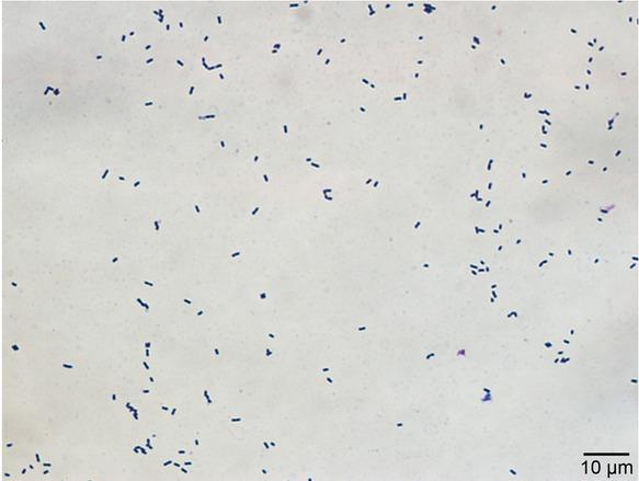 Gram staining of E. lenta isolate.