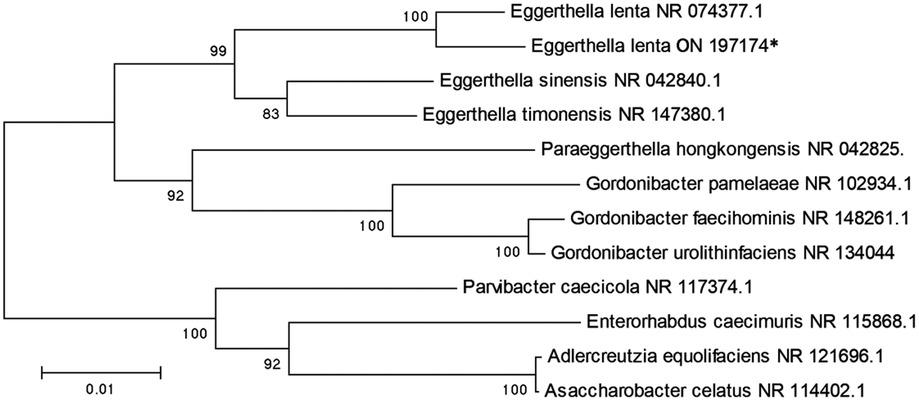 Neighbor-joining phylogenetic tree of E. lenta isolates.