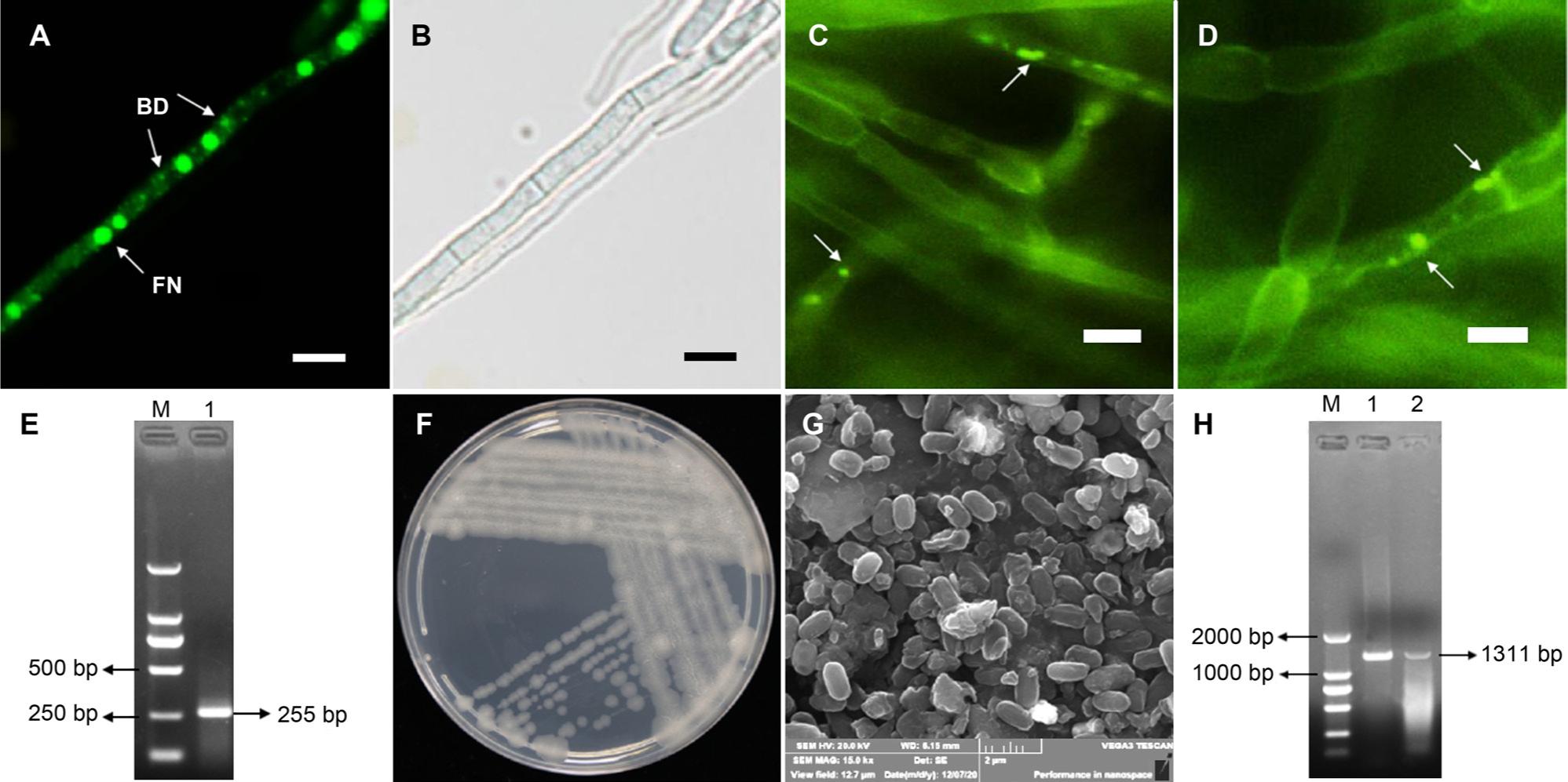 The endohyphal bacteria in Fusarium acuminatum YZU 172038.
(A, B) Fluorescent SYTO-9 nucleic acid stained hyphae under fluorescent microscopy (FN – fungal nucleus, BD – bacterial DNA), scale bars = 5 μm;
(C, D) bacteria (green signals pointed by white arrows) in hypha detected by the FISH method, scale bars = 5 μm; (E) PCR amplification of the 16S RNA gene (M – 2000 bp maker, 1 – YZU 172038); (F) colony morphology of EHB YZASR384 on LA medium;
(G) scanning electron microscopy of EHB YZASR384; (H) PCR amplification of endoglucanase gene (1 – EHB YZSR384, 2 – YZU 172038).