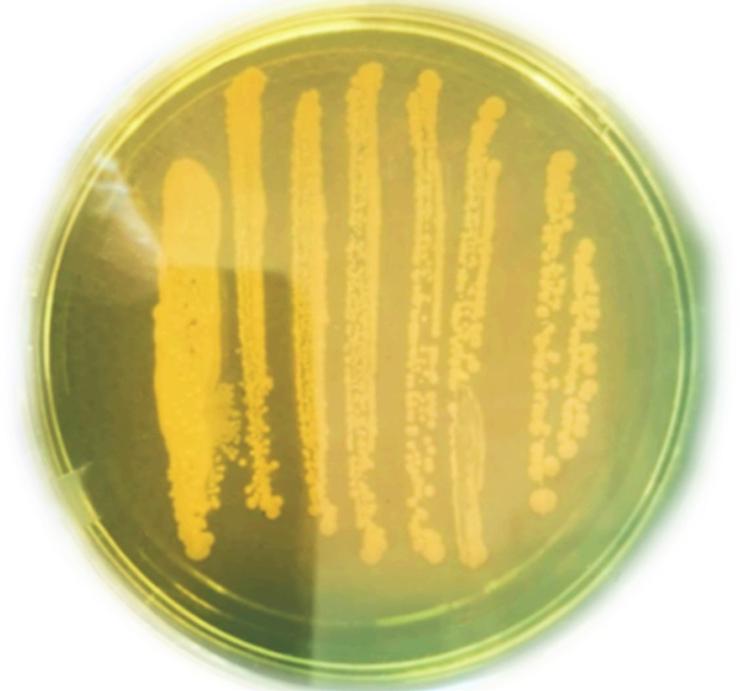 An example of Vibrio cholerae grown on TCBS media.