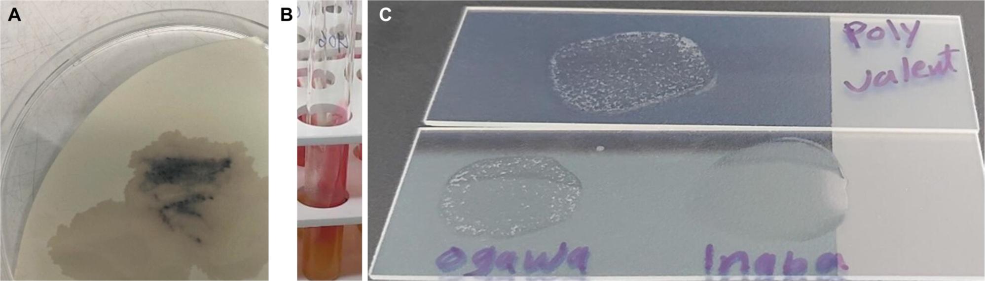 The result of the bacteriological identification of Vibrio cholerae.
A) In the oxidase test, the purple color indicates a positive result; B) KIA test, acid/alkaline, no gas, no H2S; C) serologic identification of V. cholerae, showing agglutination for polyvalent O1 antiserum and monovalent Ogawa.
