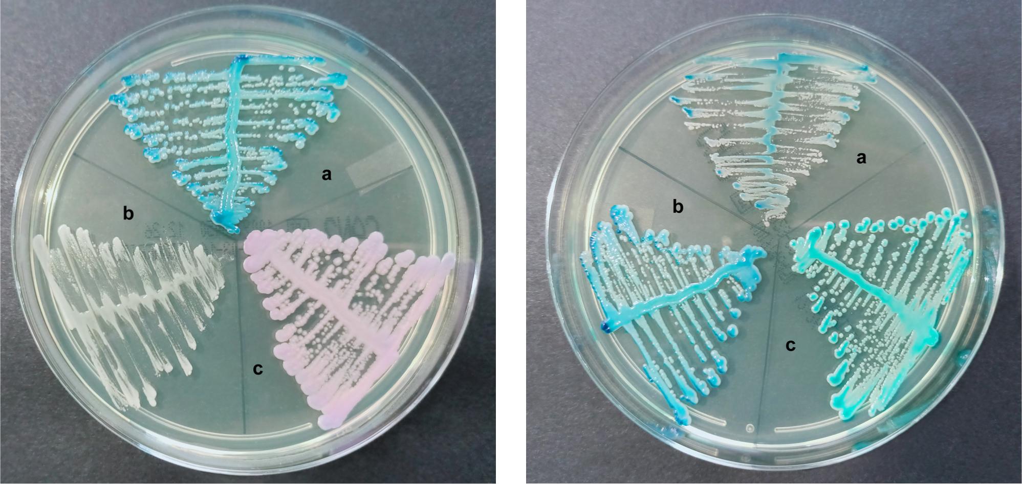 Morphology of reference strains of yeasts colonies after 48 h incubation in 37°C on chromID® Candida (bioMérieux, France).
A. a) Candida albicans ATCC® 90028™ (dark blue colonies), b) Candida glabrata ATCC® 2001™ (white colonies), c) Candida tropicalis ATCC® 9968™ (pink colonies).
B. a) Candida africana ATCC® MYA 2669™ (small, light blue colonies), b) Candida albicans ATCC® 90028™ (dark blue colonies), c) Candida dubliniensis clinical strain (turquoise colonies).