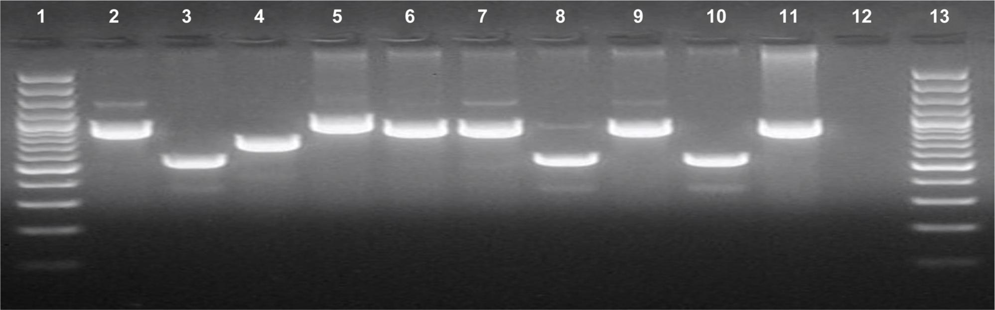 Representative samples of the hwp1 gene PCR assay visualised in electrophoresis.
Line 1 and 13 – molecular weight marker (O’GeneRuler 50 bp DNA Ladder; Thermo Scientific, USA)
Line 2 – positive control of Candida albicans ATCC® 90028™ (product size 941 bp). Line 3 – positive control of Candida dubliniensis NCPF 3949 (product size 569 bp). Line 4 – positive control of Candida africana ATCC® MYA 2669™ (product size 700 bp)
Line 5, 6, 7, 9, 11 – clinical Candida albicans strains. Line 8, 10 – clinical Candida dubliniensis strains. Line 12 – negative control