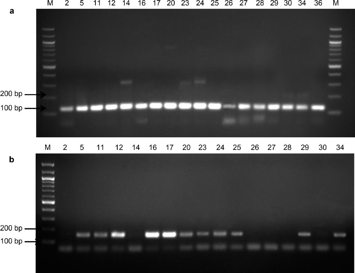 Polymerase chain reaction amplification of the specific 130 bp fragments with the IS6110 primer pair (panel a) and the specific 152 bp fragments with the mtp40 primer pair (panel b).
Lanes 2–36 of (panel a) are representative amplified PCR products with the IS6110 primers from selected sputum samples. Lanes 5, 11, 12, 16, 17, 20, 23, 24, 25, 29, and 34 of (panel b) are representative amplified PCR products with the mtp40 primers from selected sputum samples. Lanes 2, 14, 26, 27, 28, and 30 represent the samples not amplified by the mtp40 primer pair. Lanes M (panels a and b) represent the 100-bp DNA ladder.