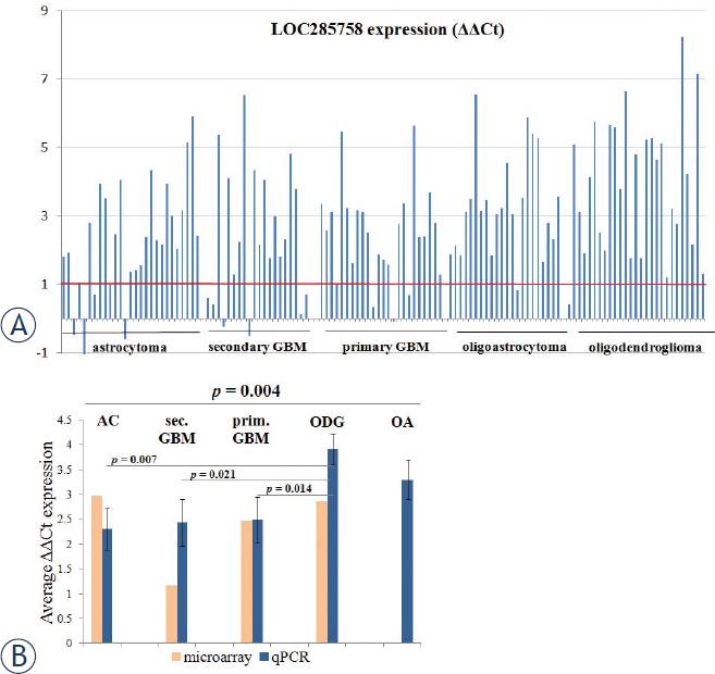 (A) Differential expression of LOC285758 in individual samples (y-axis presents ΔΔCT values). (B) Comparison of average ΔΔCT values for individual glioma subtype, determined by microarray and qPCR. Oligoastrocytoma samples were not included in microarray analysis. ΔΔCT represents difference of gene’s expression in comparison to brain reference RNA, and the positive values mean that gene’s levels are increased. p-values were determined for qPCR data (ANOVA for comparing all five subtypes and Mann-Whitney U-test for comparing two subtypes).